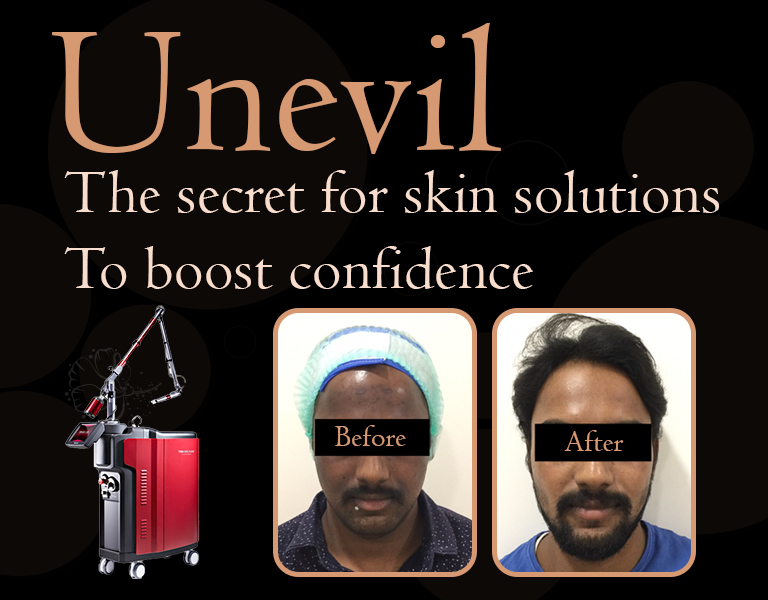Unevil the secret for skin solutions to boost confidence